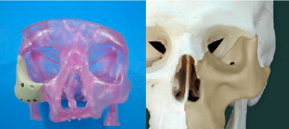 3-D printing furthers medical advancements