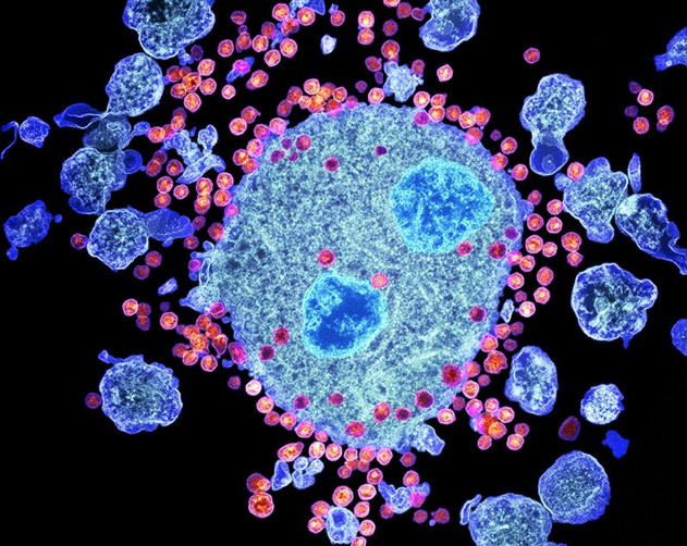 HIV infects and destroys T-cells Photo Courtesy of ReachMD